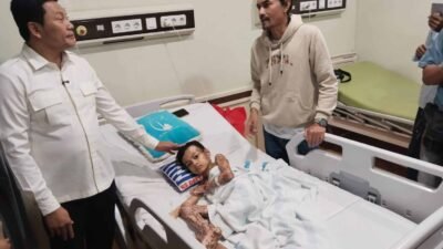 Bupati Sidoarjo Beri Secercah Harapan Untuk Izzan Melawan Luka Bakar